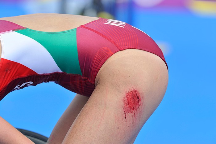 Zsofia Kovacs của Hungary bị chấn thương trong một va chạm khi đang thi đấu 3 môn phối hợp.